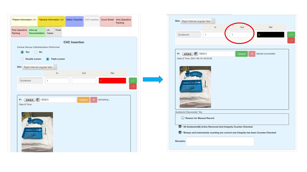 The AI image-based system verifies medical staff’s count of guidewires in real time (as indicated by the circle). 