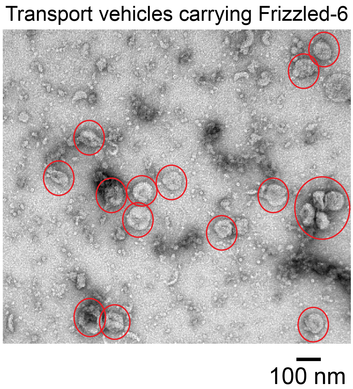 Transport vehicles carrying Frizzled-6