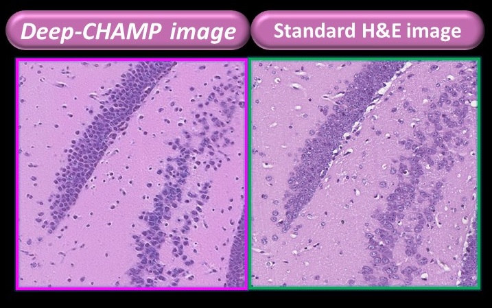 Comparison of the tissue images presented by the microscope developed by PhoMedics (left) and the FFPE tissue (right) – existing gold standard methodology for cancer cell imaging. The former can be displayed within 3 minutes while the latter takes about a week.