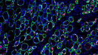 科大團隊破解幹細胞變化之謎   為抗衰老研究邁進一大步