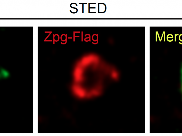 (左) 在干细胞微环境中表达的「间隙连接蛋白」 (中) 在干细胞中表达的「间隙连接蛋白」 (右) 干细胞微环境和干细胞中的间隙连接蛋白形成的通道